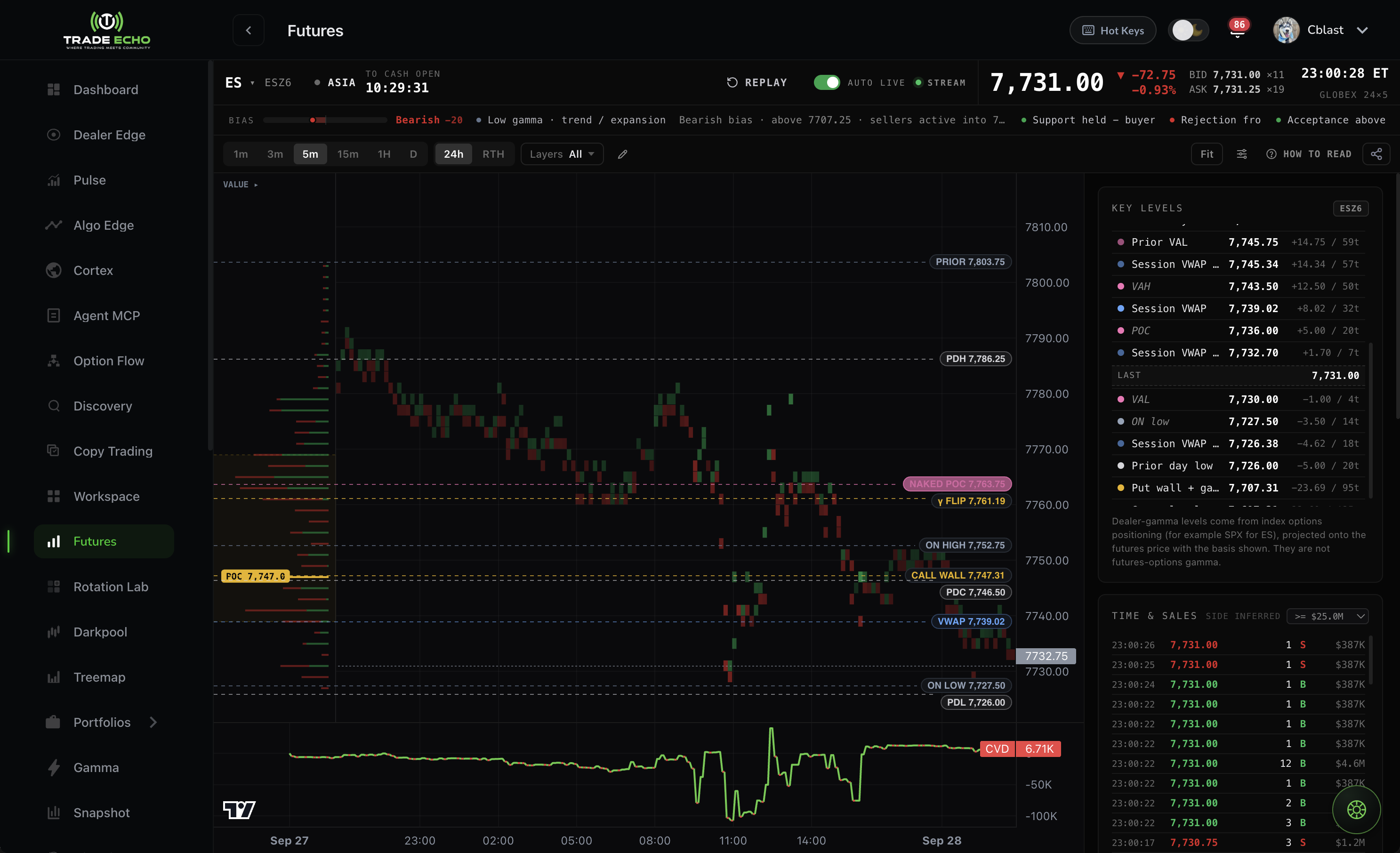 The Echo Map - live ES futures with dealer gamma levels, volume profile, and CVD